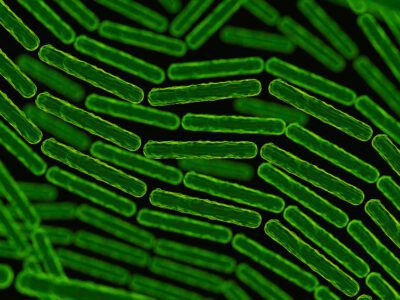 Laktik Asit Bakterileri Nedir? Özellikleri Nelerdir?